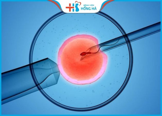 Phương pháp thụ tinh ống nghiệm IVF