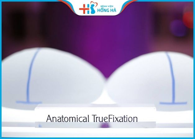 Anatomical TrueFixation mang lại cảm giác mềm mượt như ngực tự nhiên