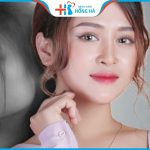 Phẫu thuật Nâng gò má tạo gương mặt đẹp tự nhiên, không góc chết