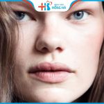 Mũi diều hâu là như thế nào? tốt hay xấu? có sửa được không