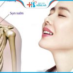 Chuyên gia giải đáp: Nâng mũi sụn sườn có vĩnh viễn không?
