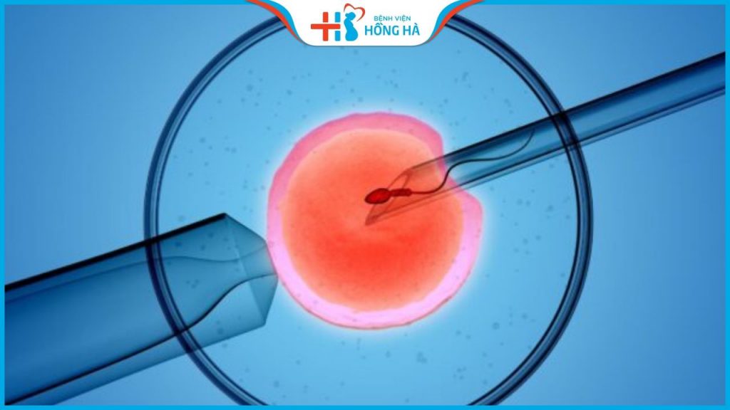 Thụ tinh trong ống nghiệm: Cơ hội mang thai thành công lên đến 50%