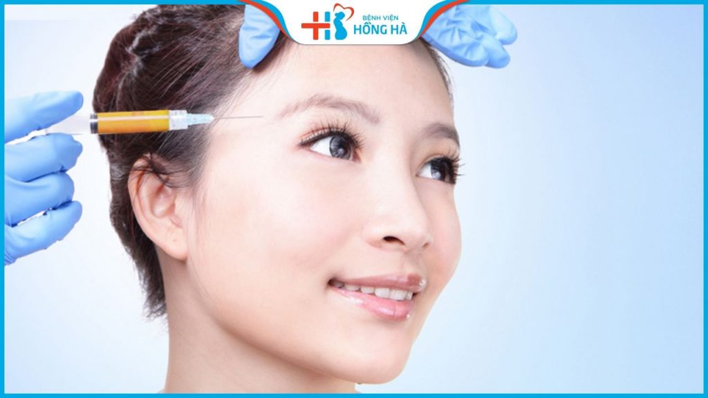 Cấy mỡ thái dương được bao lâu? Có an toàn không? Giá bao nhiêu