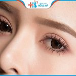 Cắt Mí Thái Lan Hồng Hà: Bí quyết để có đôi mắt to tròn, long lanh