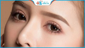 Cắt Mí Thái Lan Hồng Hà: Bí quyết để có đôi mắt to tròn, long lanh