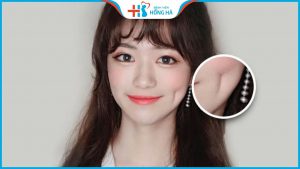 Má lúm đồng điếu: Sở hữu nét duyên thầm nhanh chóng chỉ sau 20 phút