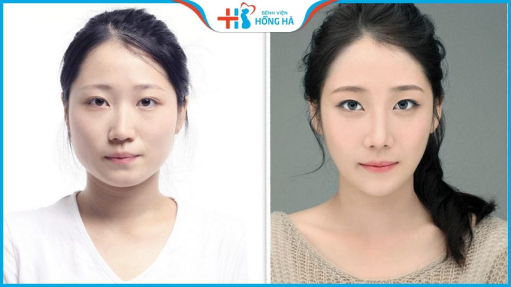 Mặt chữ điền đẹp hay xấu? Vận mệnh tướng số có tốt không?