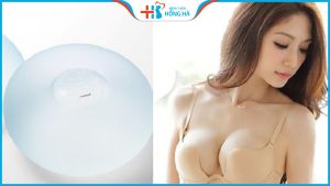 Nâng ngực nano chip: Vòng 1 đẹp ở mọi tư thế, độ bền cao