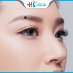 Nốt ruồi ở lông mày có ý nghĩa gì:”TỐT” hay “XẤU”