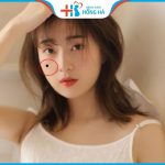 Vị trí nốt ruồi ở má nam và nữ nói lên điều gì? Phúc hay họa?