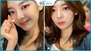 Tạo khóe môi cười đẹp tự nhiên- Giá rẻ – Xinh xắn – Quyến Rũ