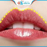 Tạo môi chẻ đẹp hay xấu? Cách làm môi trẻ đẹp tự nhiên, vĩnh viễn