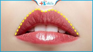 Tạo môi chẻ đẹp hay xấu? Cách làm môi trẻ đẹp tự nhiên, vĩnh viễn