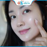 Trị sẹo thâm sau mụn: Bí quyết dưỡng da đẹp mịn sau 7 ngày