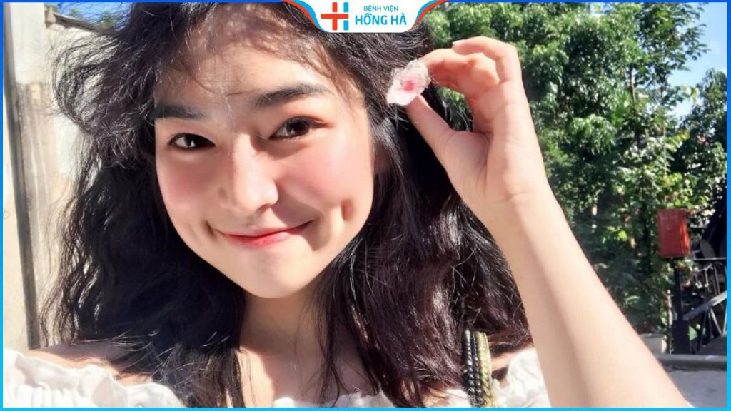 Chi phí làm má lúm đồng tiền? Bảng giá nhấn má lúm tại Thẩm mỹ Hồng Hà