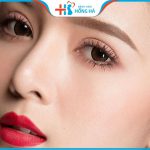 Bấm mí/nhấn mí là gì? Phân biệt cắt mí với bấm mí trong thẩm mỹ