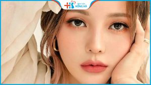 Bấm mí ăn gì? Kiêng gì? Giải đáp từ bác sĩ BV Hồng Hà