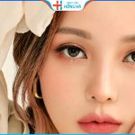 Bấm mí bao nhiêu tiền? Có nên bấm mí giá rẻ không?