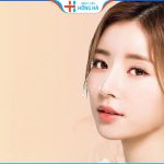 Bảng giá nâng mũi S line tại bệnh viện Hồng Hà 2022