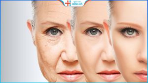 TOP 11 cách làm căng da mặt tại nhà và các lưu ý cần biết