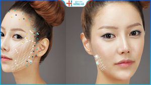 Căng da mặt bằng chỉ có đau không? Địa chỉ thẩm mỹ an toàn