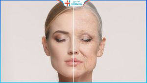 Căng da mặt bao nhiêu tiền? 5 Yếu tố ảnh hưởng đến giá