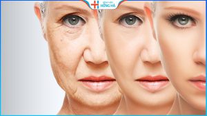 Căng da mặt ở đâu uy tín, an toàn? Review từ khách hàng