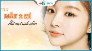 Bảng giá cắt mí mắt Hồng Hà 2022 – Giá cắt mí mắt rẻ nhất hiện nay