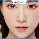 Cắt mắt 2 mí – biến hóa mắt 1 mí trở nên to tròn đẹp tự nhiên cuốn hút
