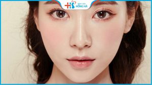Cắt mắt 2 mí – biến hóa mắt 1 mí trở nên to tròn đẹp tự nhiên cuốn hút