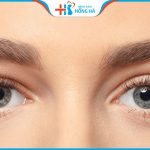 Cắt mí: Đối tượng nào phù hợp? Giá bao nhiêu?