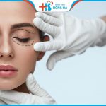 Cắt mí bao lâu thì đẹp, hết sưng – Bác sĩ thẩm mỹ BV Hồng Hà giải đáp