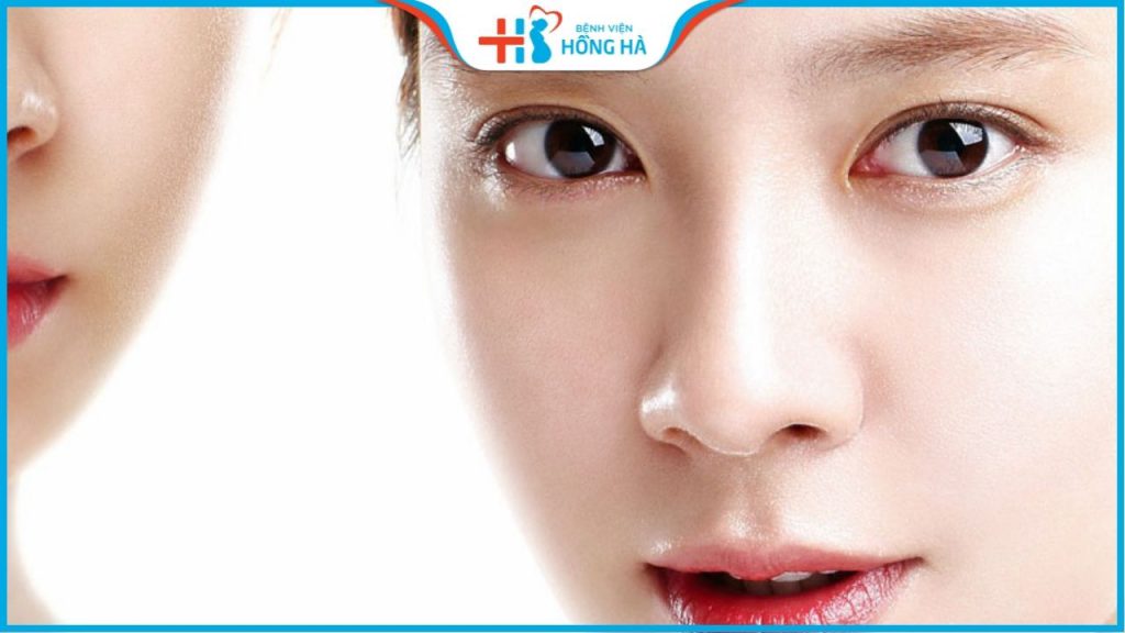 Cắt mí có đau không? Chuyên gia thẩm mỹ BVĐK Hồng Hà giải đáp