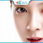Cắt mí có đau không? Chuyên gia thẩm mỹ BVĐK Hồng Hà giải đáp