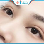 Có nên nâng cung chân mày không?4 điều cần biết