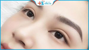 Có nên nâng cung chân mày không?4 điều cần biết