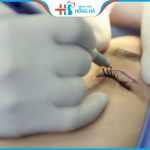 Địa chỉ bấm mí đẹp tự nhiên, an toàn tại Hà Nội, TP. Hồ Chí Minh
