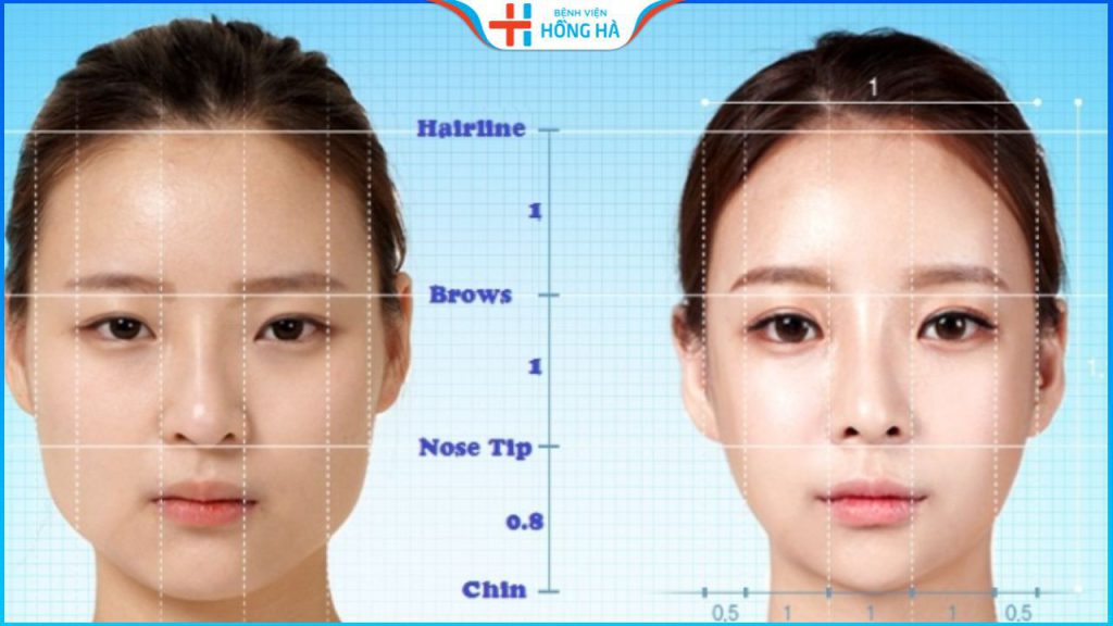 Phẫu thuật gọt hàm vuông là gì? Giá bao nhiêu? Gọt ở đâu đẹp, uy tín?