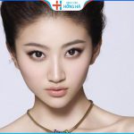 Gọt xương hàm có nguy hiểm không? Có nên thực hiện không?