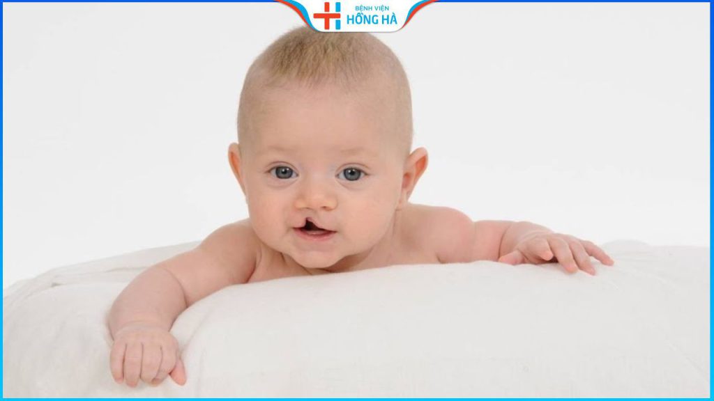 Hở hàm ếch có nguy hiểm không? Có chữa được không?