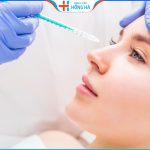 Hút dịch sau khi nâng mũi có đau không? Thời gian hút dịch tốt nhất