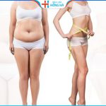 Hút mỡ có an toàn không? Có để lại di chứng gì không?
