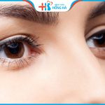 Nâng cung mày đẹp ở đâu? Nâng cung mày có đau, có để lại sẹo không?