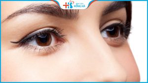Nâng cung mày đẹp ở đâu? Nâng cung mày có đau, có để lại sẹo không?