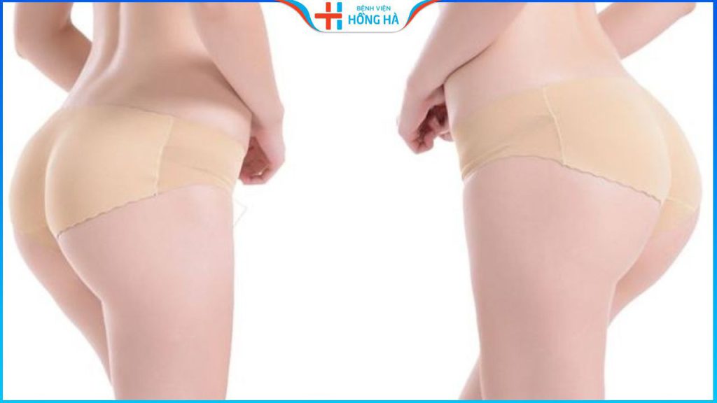 Nâng mông có nguy hiểm không? Kinh nghiệm nâng mông an toàn