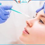 Nâng mũi bằng filler có đau không? Hiệu quả giữ được bao lâu