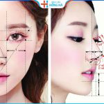Nâng mũi cấu trúc khác gì nâng mũi thường? Nên chọn loại nào?