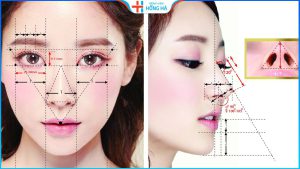 Nâng mũi cấu trúc khác gì nâng mũi thường? Nên chọn loại nào?