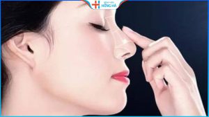 Nâng mũi là tiểu phẫu hay đại phẫu- Chuyên gia BV Hồng Hà giải đáp