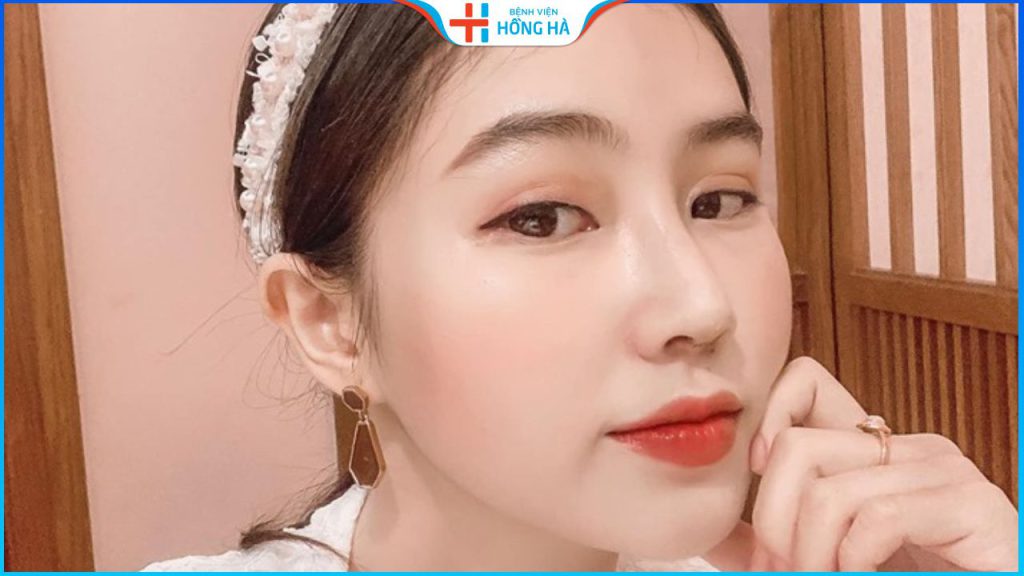 TOP 2 Địa chỉ nâng mũi uy tín tại Hà Nội được ưu chuộng nhất